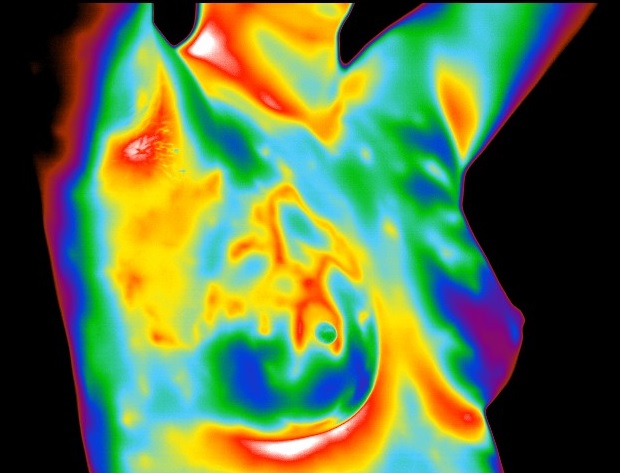 Great Falls Thermography at Natura Health & Wellness Clinic
